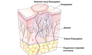 Какво се случва, ако брадавицата и сълзата може да ви режат на брадавици