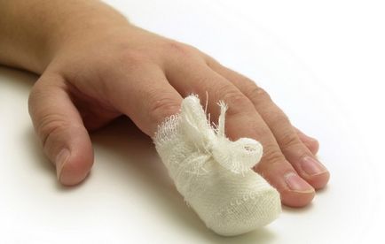 Какво да правите, когато травма на ноктите, които ще ви помогнат и че той е безполезен за