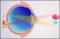 Далекогледство - замъглено зрение (рефракция) - заболявания на очите