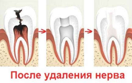 Какво арсен в зъба - действието и употребата на арсен