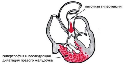 Eos (електрически ос на сърцето) и отклонение на позиция