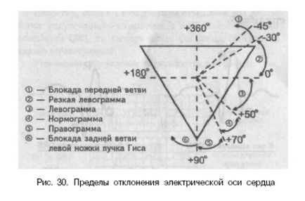 Eos (електрически ос на сърцето) и отклонение на позиция