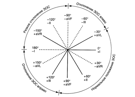 Eos (електрически ос на сърцето) и отклонение на позиция
