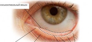 Когато е конюнктивалния сак, болестта на човешкото око