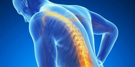 Изкривяването на характеристиките на гръбнака деформационни и симптомите, как да се изправите стойката си и да се предотврати