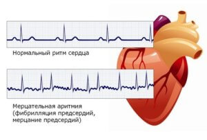 Как боли надбъбречните симптоми