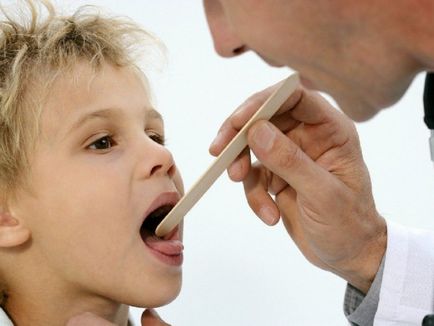 Какви са причините за жълти петна по езика