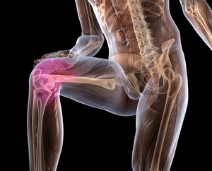 Как за лечение на остеоартрит на коляното в дома лечение на най-различни начини