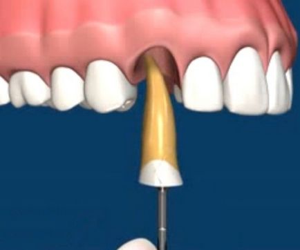 Как за лечение на зъбите при зъболекаря