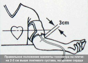 Как да се измери налягането на ръката тонометър причините за отклонения от