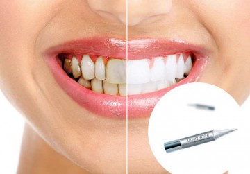 Как да използвате молив за избелване на зъбите