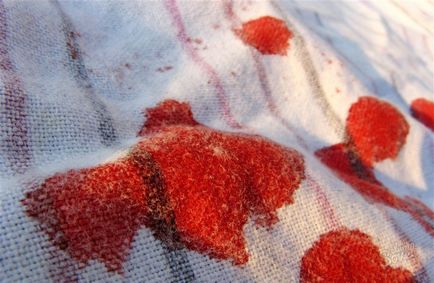 Как да се зарази с ХИВ чрез кръвта могат да бъдат заразени от питейна заразена кръв, колкото е необходимо