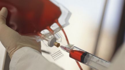 Как да се зарази с ХИВ чрез кръвта могат да бъдат заразени от питейна заразена кръв, колкото е необходимо