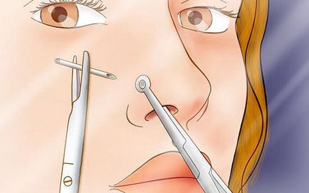 Как да прониже носа