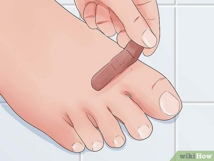 Как да проверите дали раната е възпалена