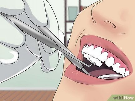 Как да се следи здравето на зъбите
