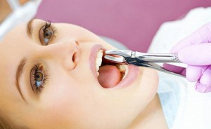 Как да се запишете на развалени зъби защо те гният, последствията за организма, какво да правя