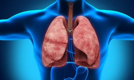 Как да се засили на белите дробове и бронхите 1