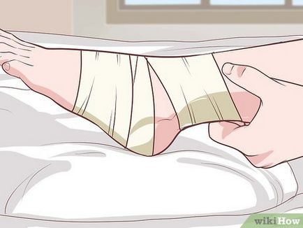 Как да се възстанови от операция на крака му