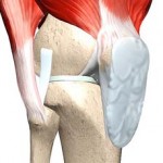 Контрактура коляното за лечение на коляното