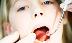 Какво да правим с паднал бебе зъб дете - съвети за родители