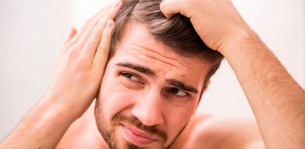 Плешивост при лечение мъже, причините, как да се отървете от косопад