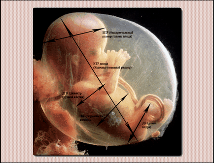 На какъв срок ултразвук определя бременност