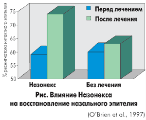 NASONEX при за лечение на синузит - бърза помощ за възрастни и деца (лечение) NASONEX при за лечение на синузит - бърза помощ за възрастни и деца
