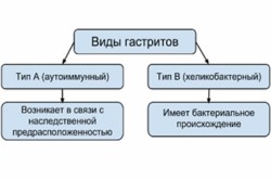 Усещане за буца в стомаха