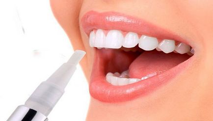Избелване на зъби молив как да си изберете и използване мнения