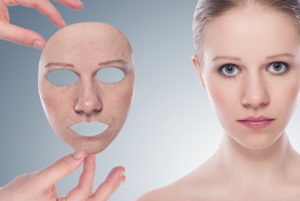 Изгореното на лицето й как ефективно да се справят с последствията