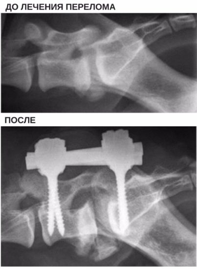 фрактура на гръбначния стълб на котката и симптомите на котката, вида на компресия, лечение, как да възстановите