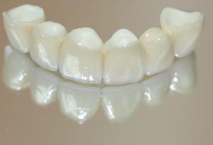 Пластмасови протези плюсовете и минусите на пластмасови зъби, ревюта, цена