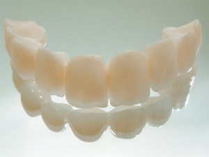 Пластмасови протези плюсовете и минусите на пластмасови зъби, ревюта, цена