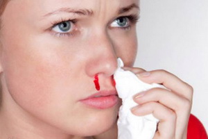 Защо е кървене от носа и как да се спре лекарството, симптомите, причините за епистаксис