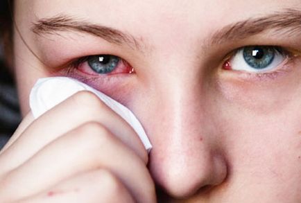 Защо да се изчервявам бялото на очите, как да се отървете от болестта