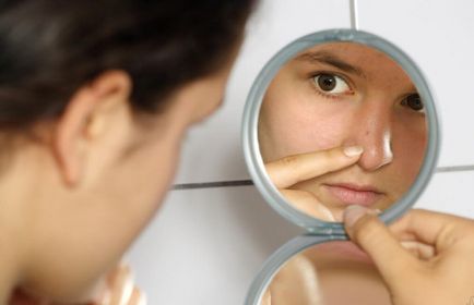 Защо не може да изтръгне пъпки последици от притискане на кожата на лицето и тялото