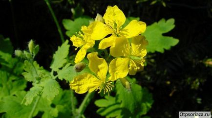 Псориазис снимката ръце етап на лечението, както и причината (ръце) Псориазис по ръцете на снимка, сцена, лечение и причини