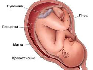 Местоположение на плацентата на предната стена на протичането на бременността и потенциалните рискове