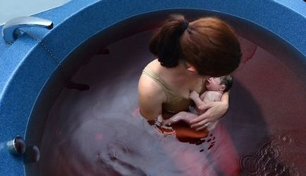 Родовете във вода (доставяне) Родовете във вода