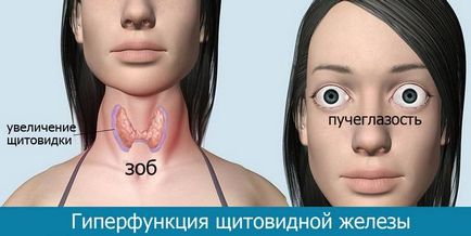 Симптомите на хиперфункция на щитовидната жлеза при хора, про shchitovidku