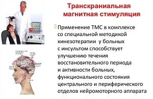 Транскраниална магнитна стимулация на мозъка цели, ревюта, характеристики