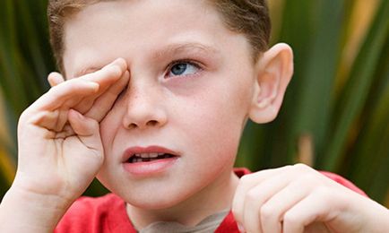 симптоми Увреждане на очите, причини, лечение