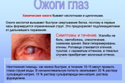симптоми Увреждане на очите, причини, лечение