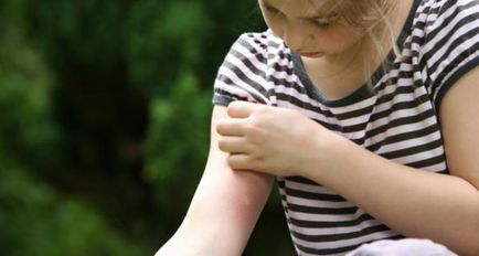 ухапване от комар в лечението на децата, как да се определи колко е опасно, как да се отнасяме