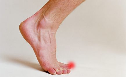 нокти синина на крака си - симптомите, първа помощ и лечение,