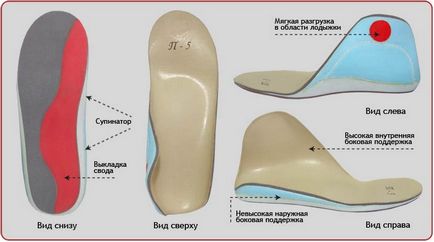 Valgus крак деформация при деца снимка патология