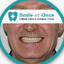 Възстановяване на счупен преден зъб