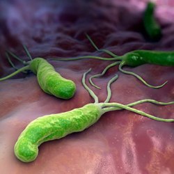 Helicobacter пилори симптоми и лечение на традиционни и народни средства