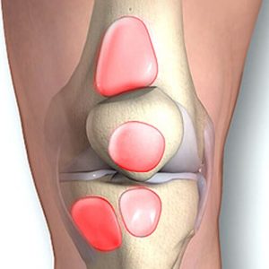 Течността в коляното, която правя, лечение, защо се събира течност в коляното